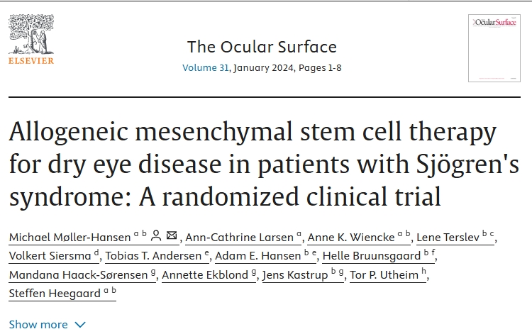 異基因間充質(zhì)干細(xì)胞治療干燥綜合征患者干眼癥：一項隨機(jī)臨床試驗