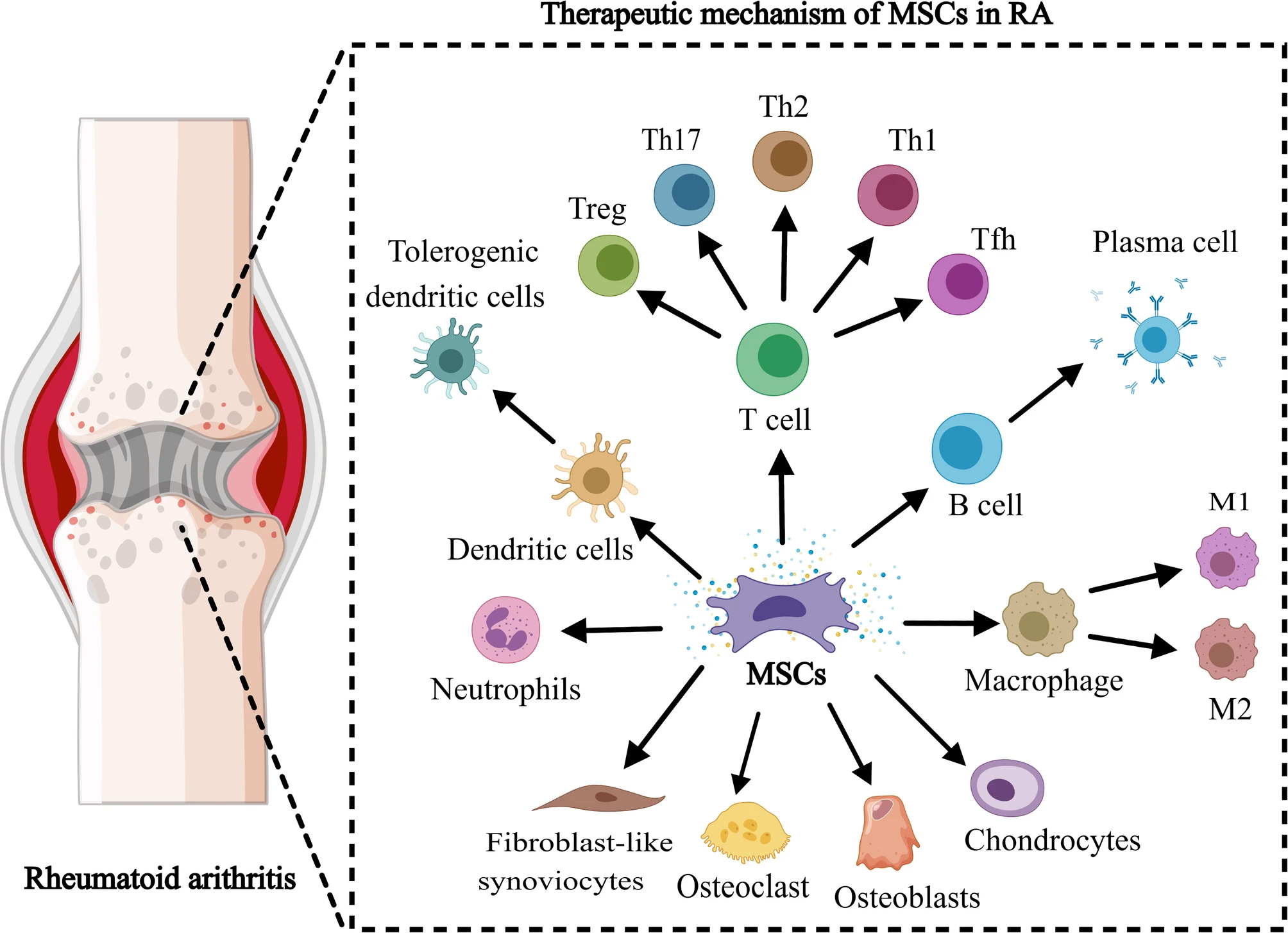 圖3：間充質(zhì)干細(xì)胞在治療類風(fēng)濕性關(guān)節(jié)炎中的機(jī)制。