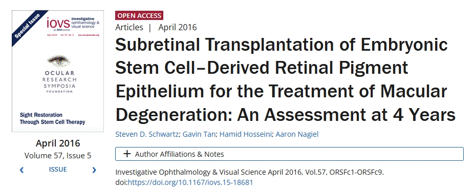胚胎干細(xì)胞來源的視網(wǎng)膜色素上皮視網(wǎng)膜下移植治療黃斑變性：4年評估