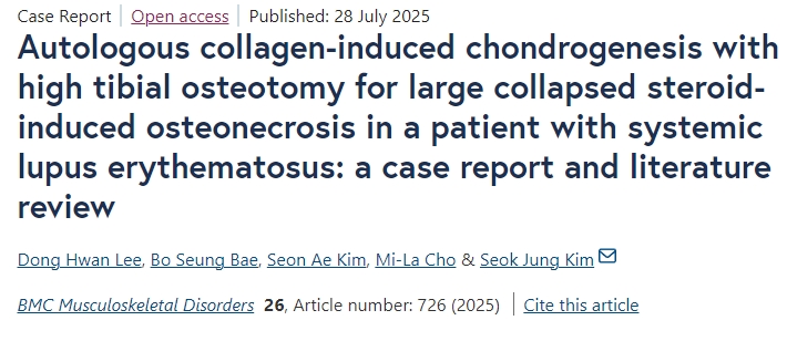 自體膠原誘導軟骨形成聯(lián)合脛骨高位截骨術(shù)治療系統(tǒng)性紅斑狼瘡患者大面積塌陷性類固醇性骨壞死：病例報告及文獻綜述