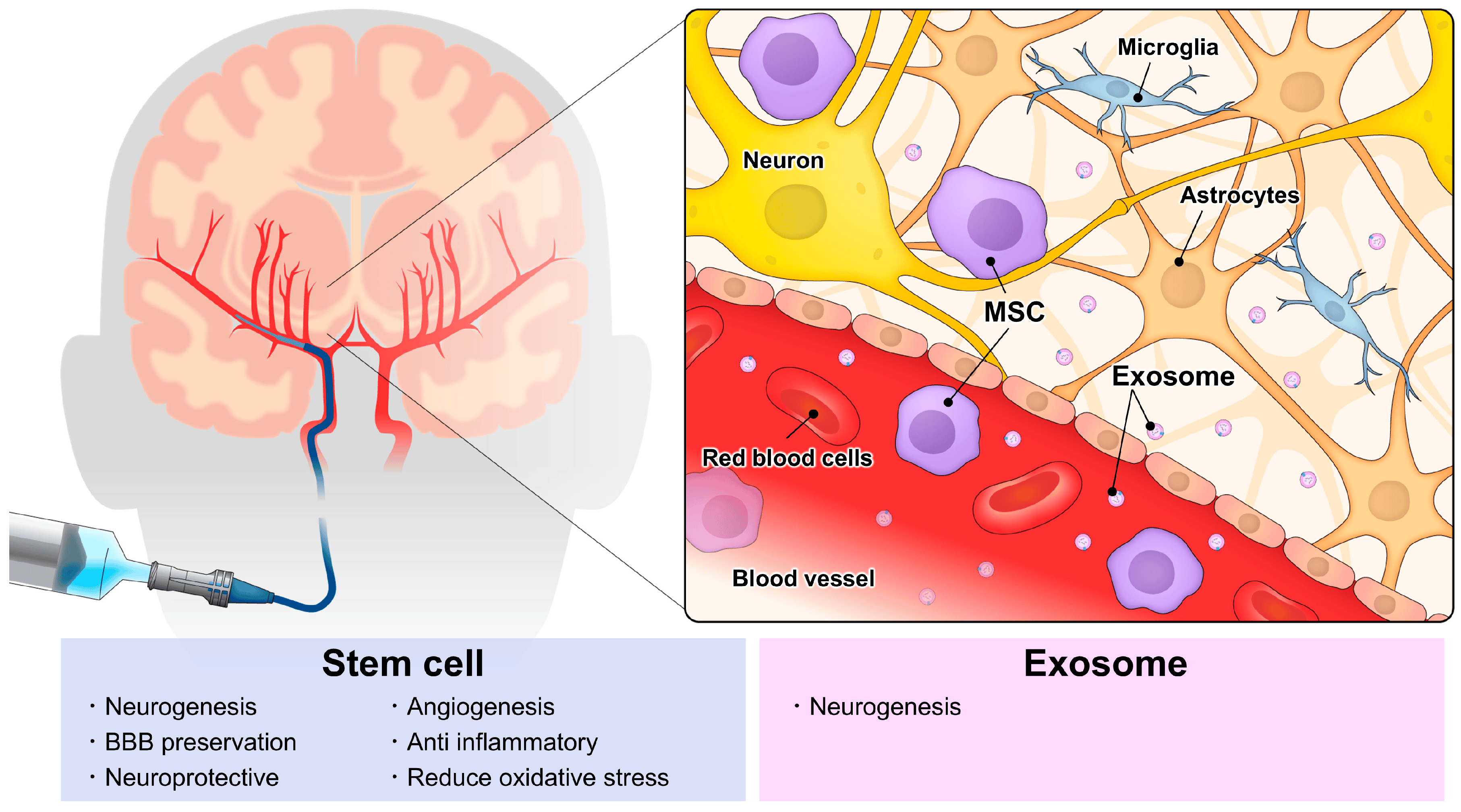 動脈注射干細(xì)胞&外泌體治療神經(jīng)系統(tǒng)疾病，打多少細(xì)胞好？