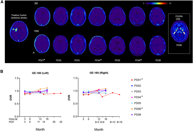 圖2：移植對(duì)象和對(duì)照對(duì)象的[18F]GE180PET掃描結(jié)果
