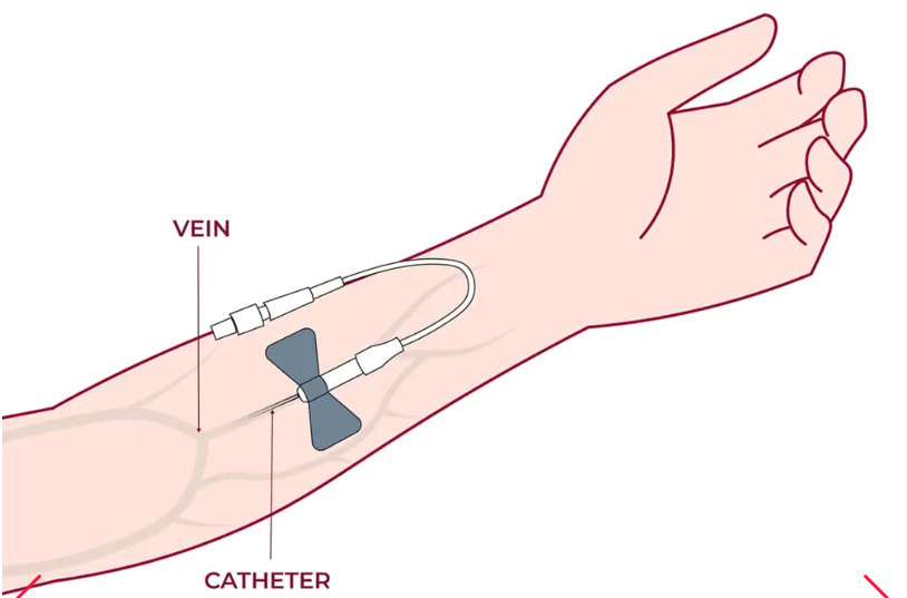 細(xì)胞通過靜脈輸注進行給藥，在某些情況下，可以使用其他輸送方法（例如鼻噴霧劑或局部應(yīng)用）來針對特定系統(tǒng)。