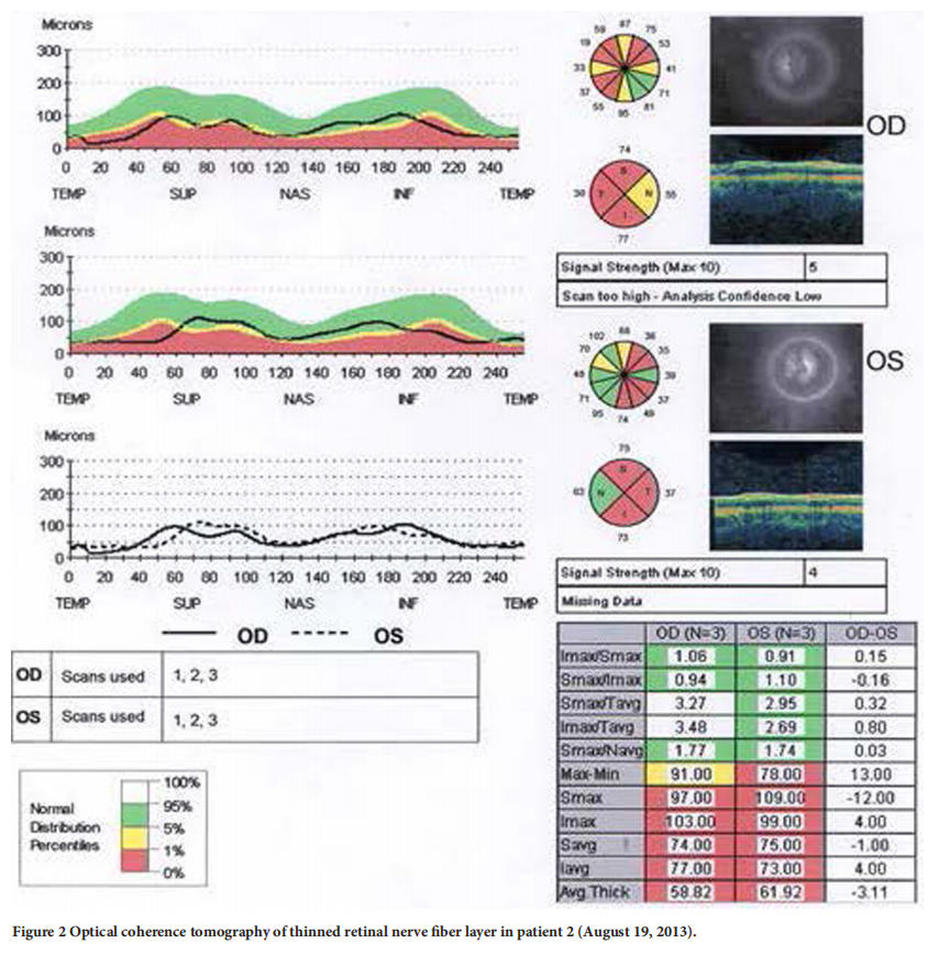 遺傳性視神經(jīng)病變臨床試驗(yàn) 遺傳性視神經(jīng)病變臨床試驗(yàn)