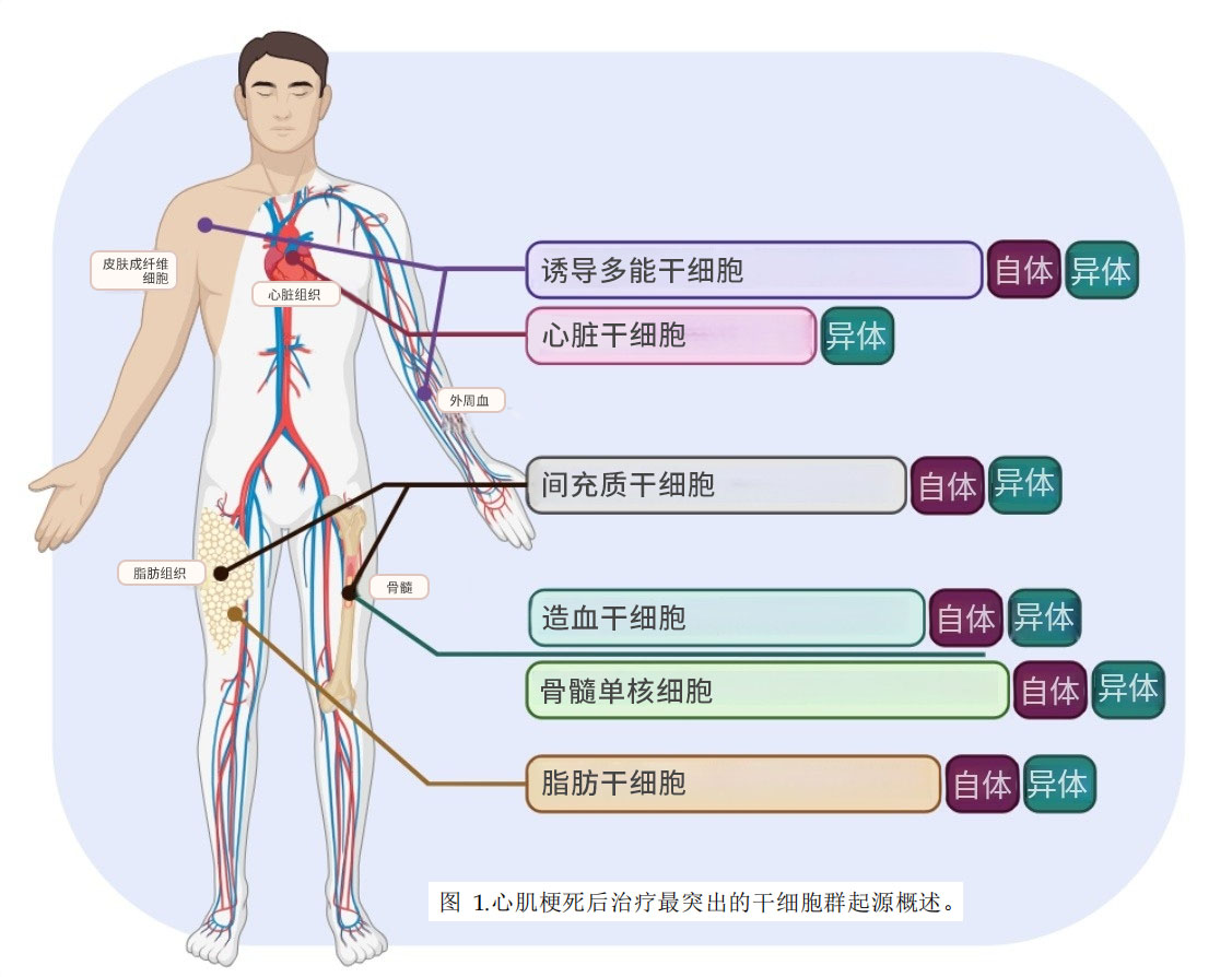 干細(xì)胞治療心梗 干細(xì)胞治療心梗