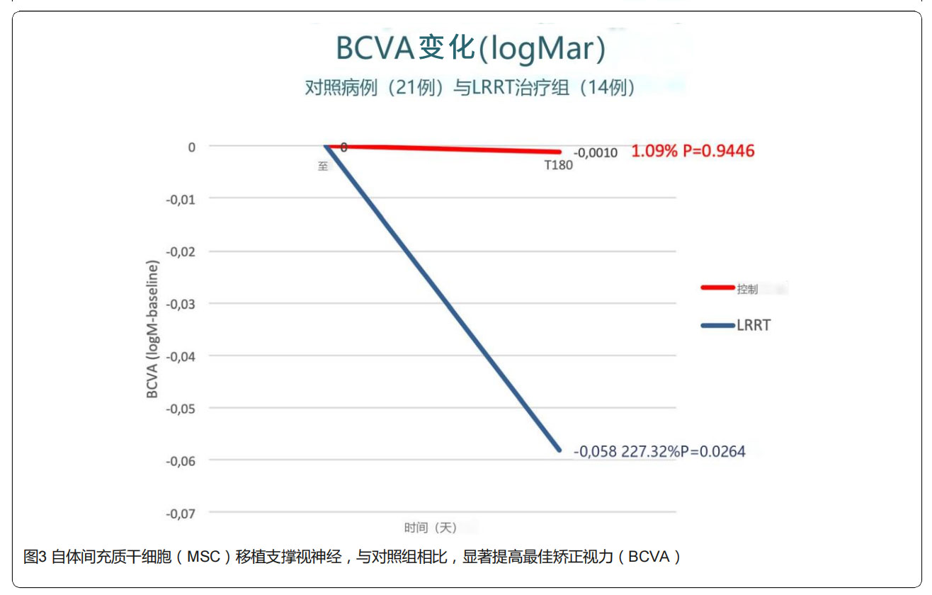 青光眼臨床試驗 青光眼臨床試驗