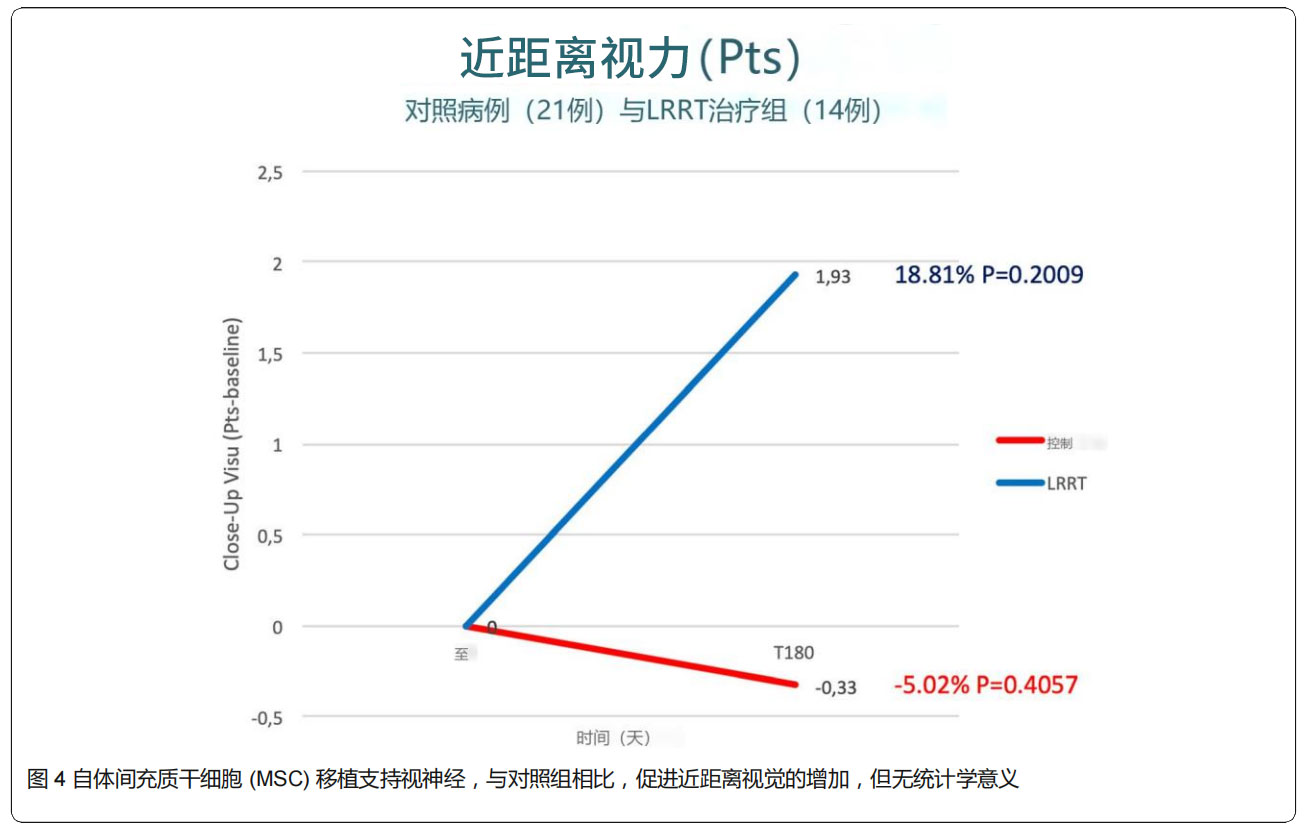 青光眼臨床試驗 青光眼臨床試驗