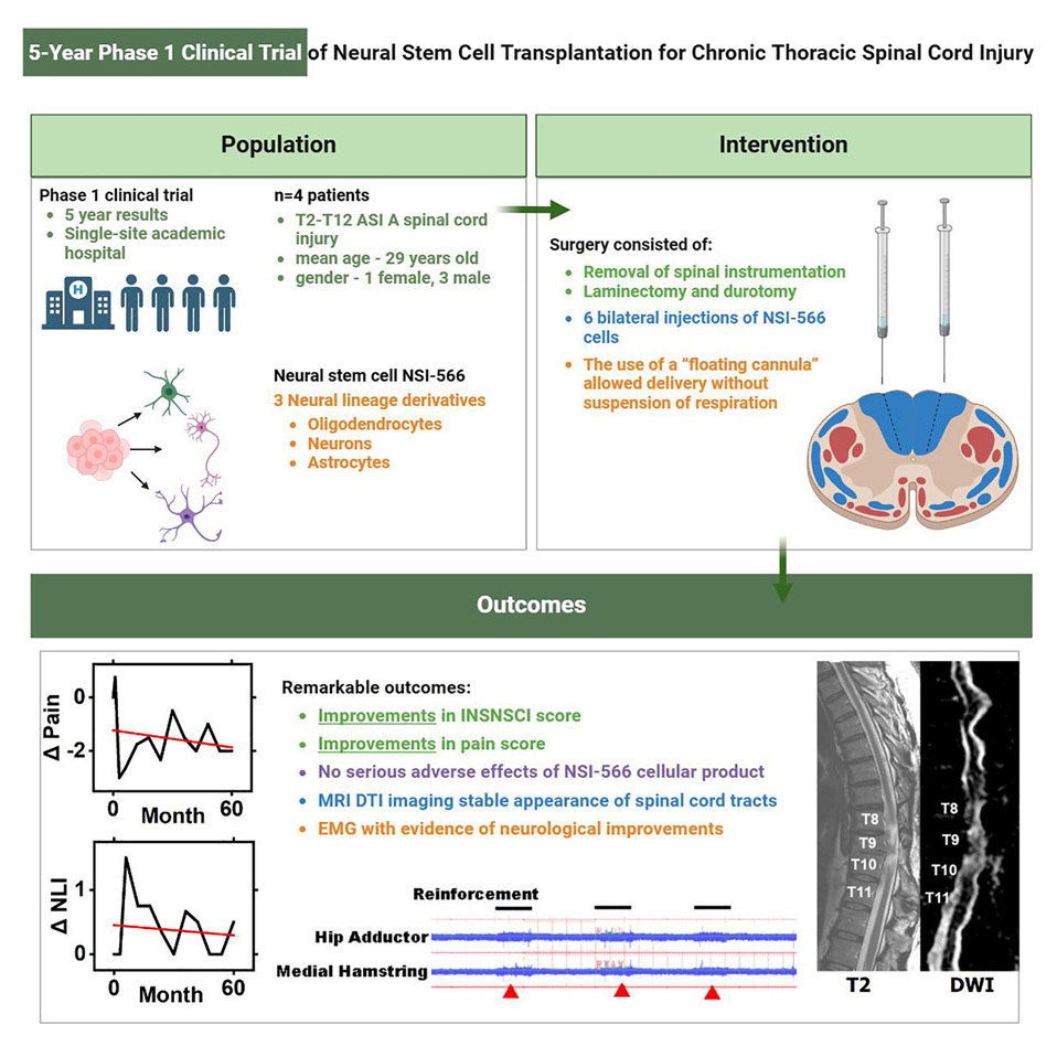 干細(xì)胞治療脊髓損傷 干細(xì)胞治療脊髓損傷