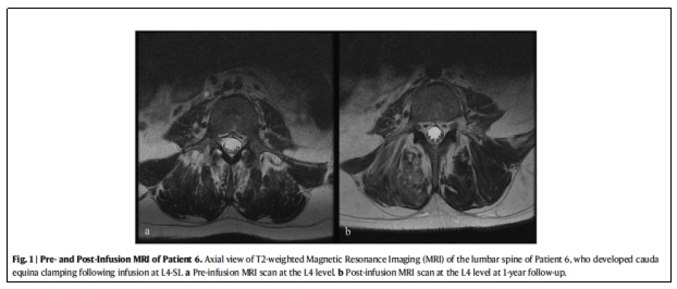 臨床試驗(yàn) 臨床試驗(yàn)