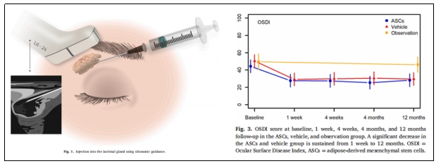 干細(xì)胞治療 干細(xì)胞治療