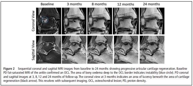 “臨床試驗(yàn)” 臨床試驗(yàn)