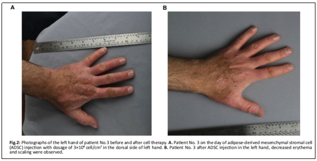臨床試驗(yàn) 臨床試驗(yàn)