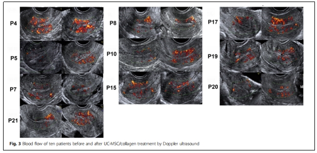 臨床試驗 臨床試驗