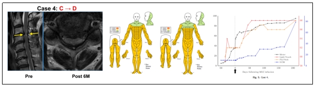 臨床試驗 臨床試驗
