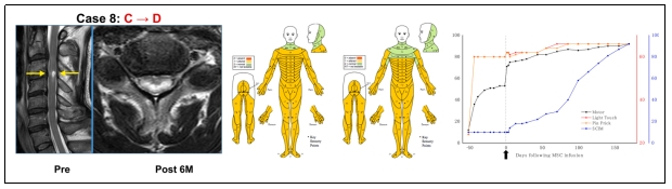 臨床試驗 臨床試驗