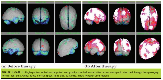 臨床試驗(yàn) 臨床試驗(yàn)