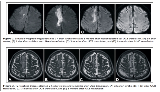 “臨床試驗(yàn)”/ 臨床試驗(yàn)