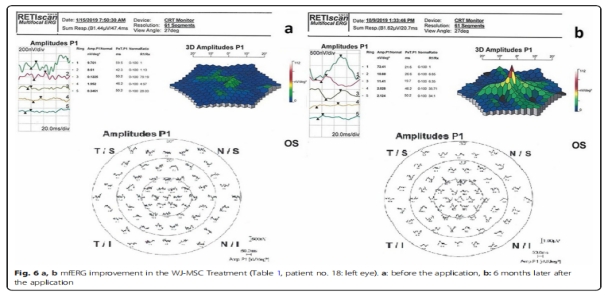 臨床試驗(yàn) 臨床試驗(yàn)