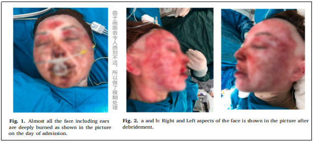 臨床試驗 臨床試驗
