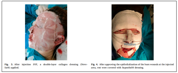臨床試驗 臨床試驗