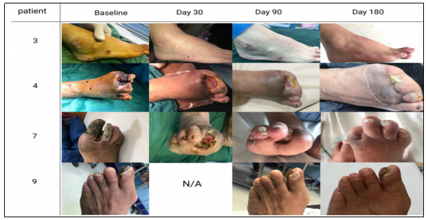 臨床試驗 臨床試驗