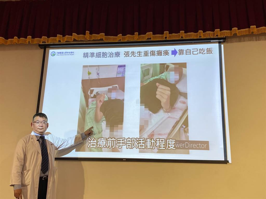 干細(xì)胞治療前