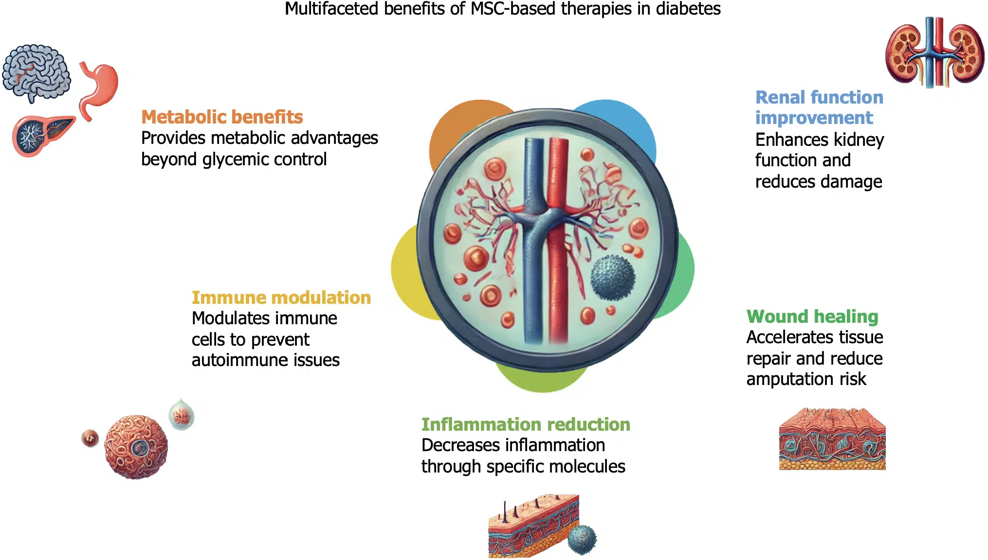 基于間充質(zhì)干細(xì)胞的療法對糖尿病患者的各種非血糖效應(yīng)