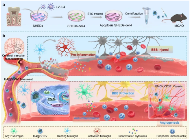 缺血性腦卒中納米囊泡IL4@SDNV治療策略示意圖