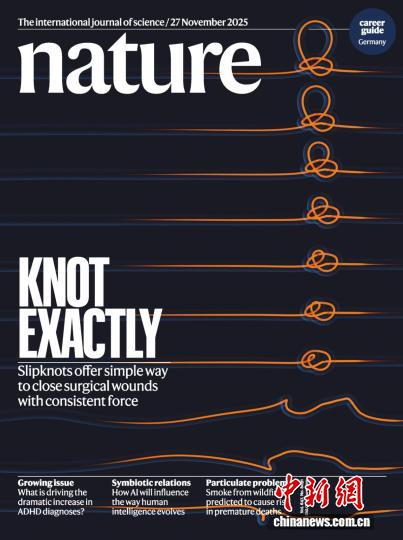 研究成果發(fā)表于國(guó)際頂級(jí)期刊《自然》并登上雜志封面。研究團(tuán)隊(duì)供圖