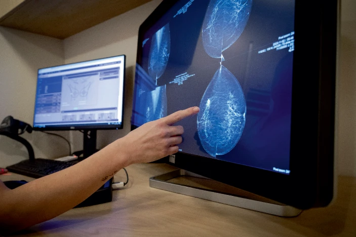 轉(zhuǎn)移性乳腺癌患者迫切需要新的治療方法。