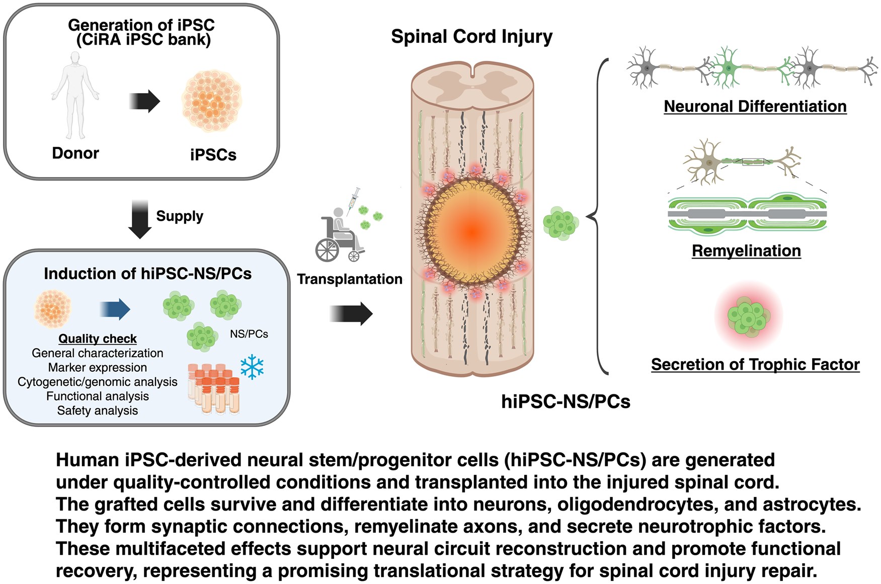 最新綜述！多能干細(xì)胞來源的神經(jīng)干/祖細(xì)胞療法治療脊髓損傷：臨床進(jìn)展和轉(zhuǎn)化展望